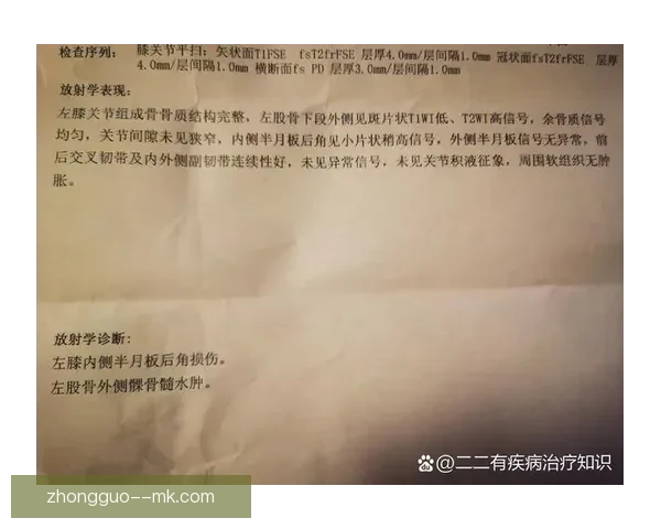 罗德里遭遇右膝前十字韧带撕裂和半月板损伤 无缘本赛季英超剩余赛程